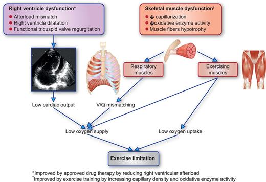 Pulmonary Hypertension European Heart Journal Oxford Academic 6358